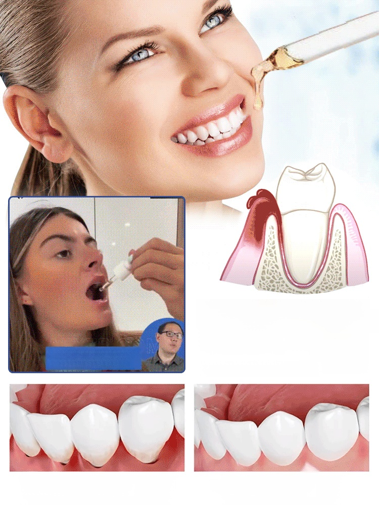 Tooth Regeneration Care Drops