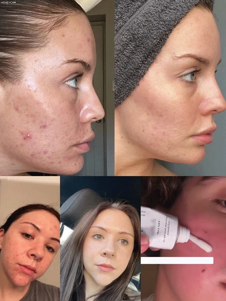 Hydrating and Nourishing Face Cream.7 Days To Brighter Skin, Flawless And Comfortable For The Whole Body