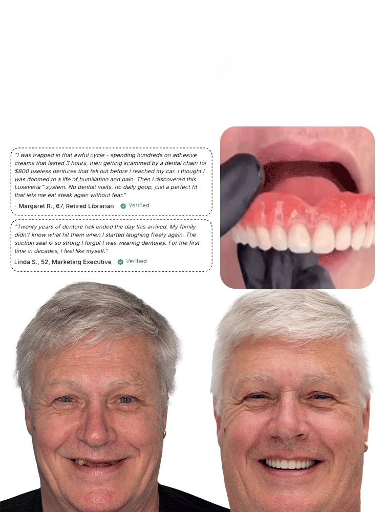 Denture Modification Kit.Naturally Invisible, Fits In One Second Without Slipping