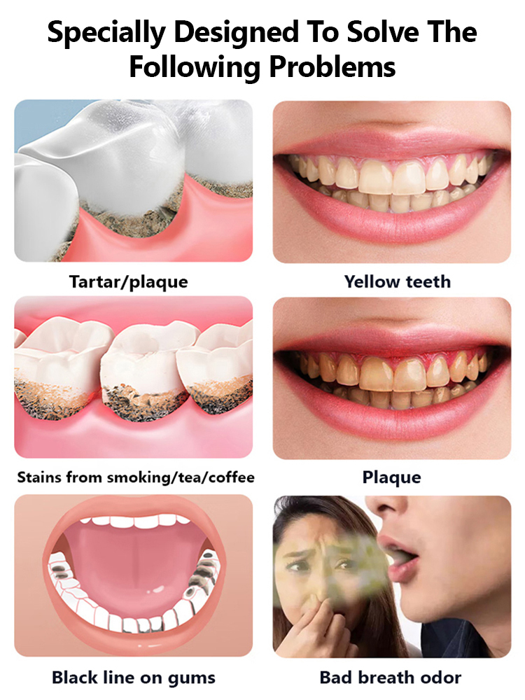 [Recommended by Dentists] Powerful Home Ultrasonic Tooth Cleaner