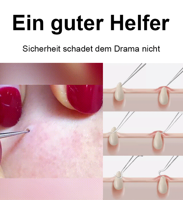 Zellklemme mit hoher Präzision und hoher Härte