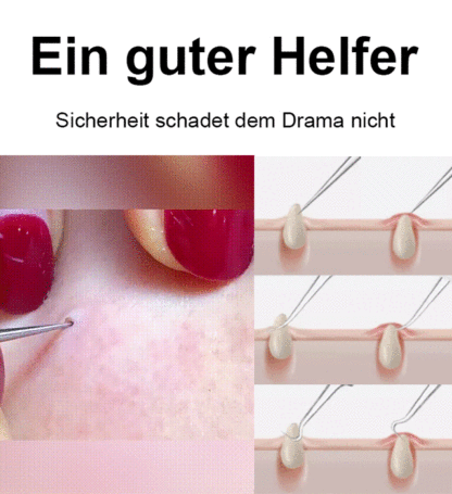 Zellklemme mit hoher Präzision und hoher Härte