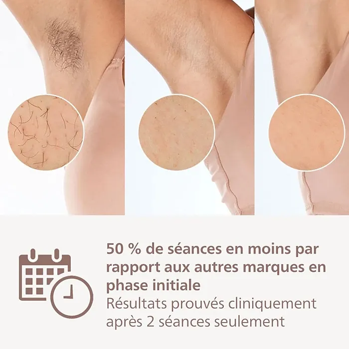 Philips Lumea IPL 9900 Series (Épilateur à lumière pulsée avec SenseIQ)