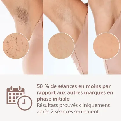 Philips Lumea IPL 9900 Series (Épilateur à lumière pulsée avec SenseIQ)