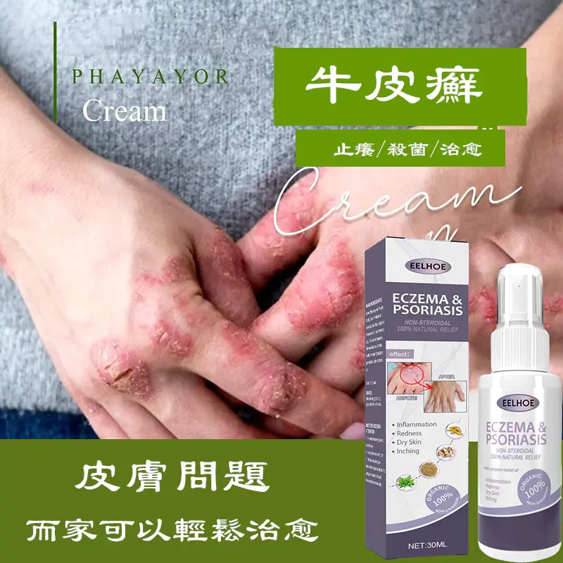 【限量300瓶】草本噴霧 溫和不刺激 針對各種皮膚問題 3天止癢/21天徹底治癒✅貨到付款 免費送貨