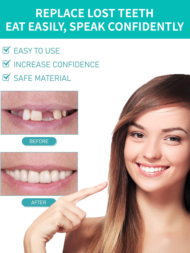 🦷The Smile Booster – Silicone Dentures – Will Instantly Make You Speak with More Confidence