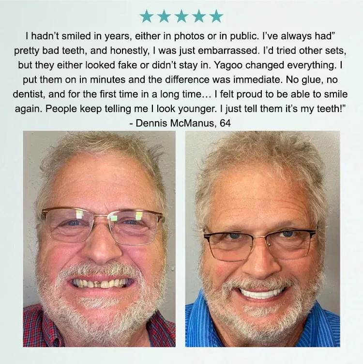 🔒No adhesive required, it adheres firmly to the gums, does not fall off easily when speaking or chewing, and is easy to use for people of all ages.