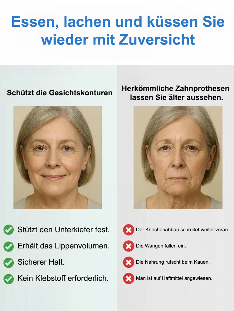 [Hergestellt in den USA, FDA-zertifiziert] Maßgefertigtes Komplett-Zahnprothesen-Set