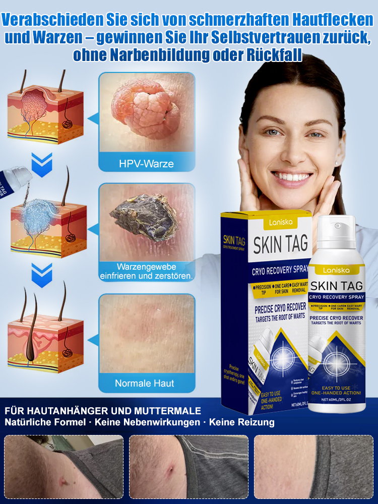 LANISKA Warzenpflege-Spray zur äußerlichen Anwendung