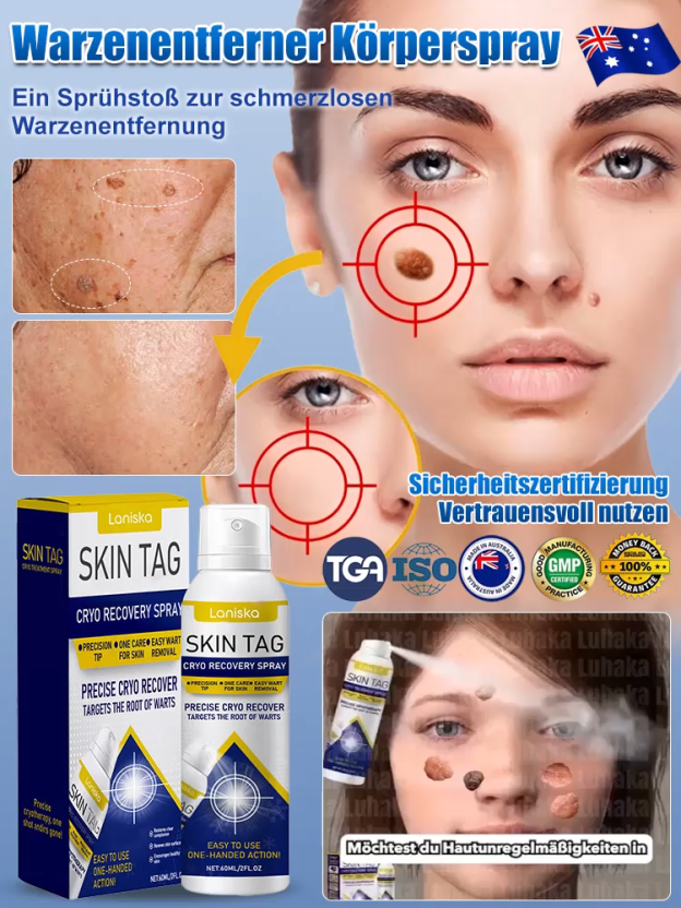 LANISKA Warzenpflege-Spray zur äußerlichen Anwendung【Kaufen Sie 1, erhalten Sie 1 gratis】