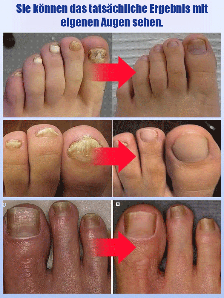 SOUTH MOON Nagelpflegemittel