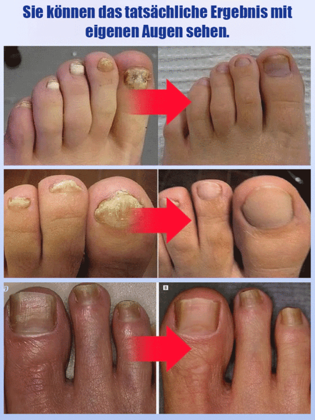 SOUTH MOON Nagelpflegemittel