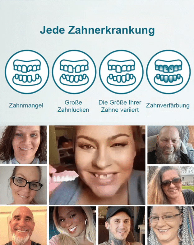 Zahnersatz-Veredelungsset für schöne Zähne【Kaufen Sie 1, erhalten Sie 1 gratis! Nur heute!】