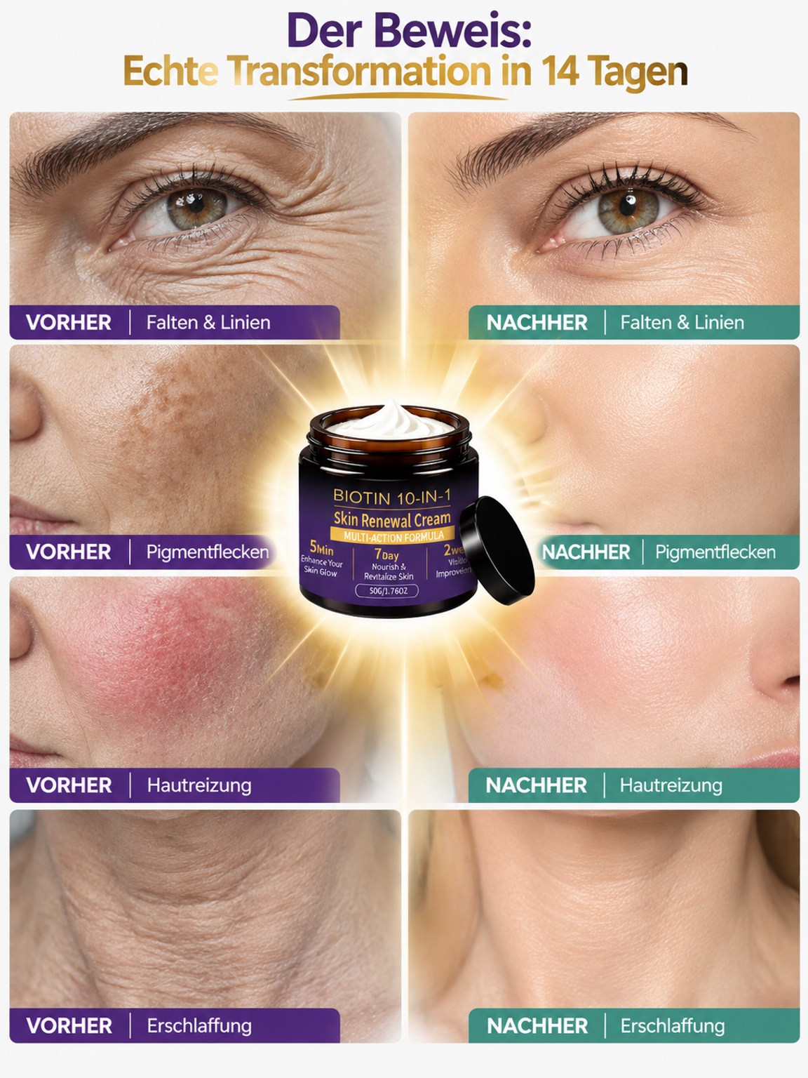 【14 Tage risikolos testen!】Schweizer Bioaktives Biotin 10-in-1 ReparaturcremeFür Männer und Frauen geeignet – persönlich getestet und wirksam!