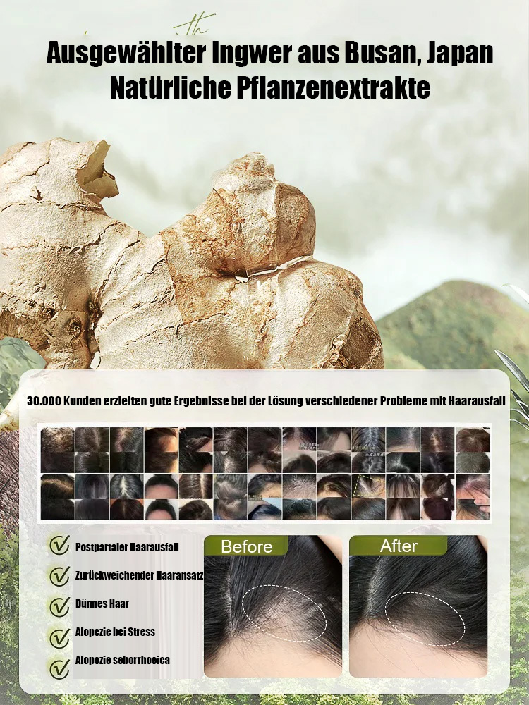 1 kaufen, 1 bekommen Explosive Ginger Phytochemical Hair Loss Control Shampoo，Wirksamer Schutz vor Haarausfall，Fördert sekundäres Haarwachstum！