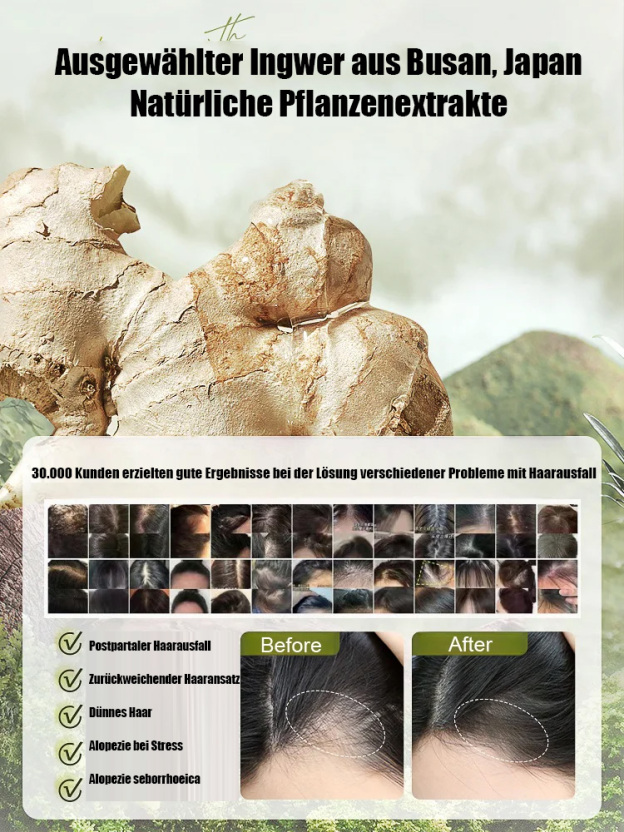 1 kaufen, 1 bekommen Explosive Ginger Phytochemical Hair Loss Control Shampoo，Wirksamer Schutz vor Haarausfall，Fördert sekundäres Haarwachstum！