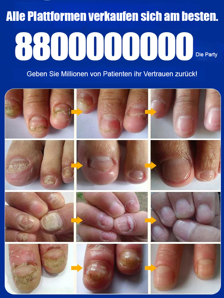 SOUTH MOON Nagelpflegemittel