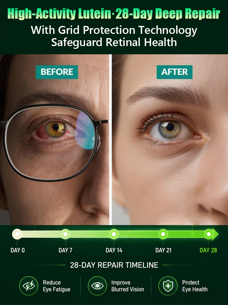 【Vision Restoration】Lutein Eye Care Spray No More Blurry Vision Restore Vision Naturally👀