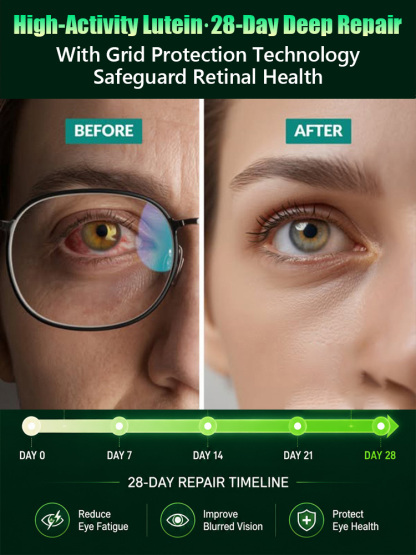 【Vision Restoration】Lutein Eye Care Spray No More Blurry Vision Restore Vision Naturally👀