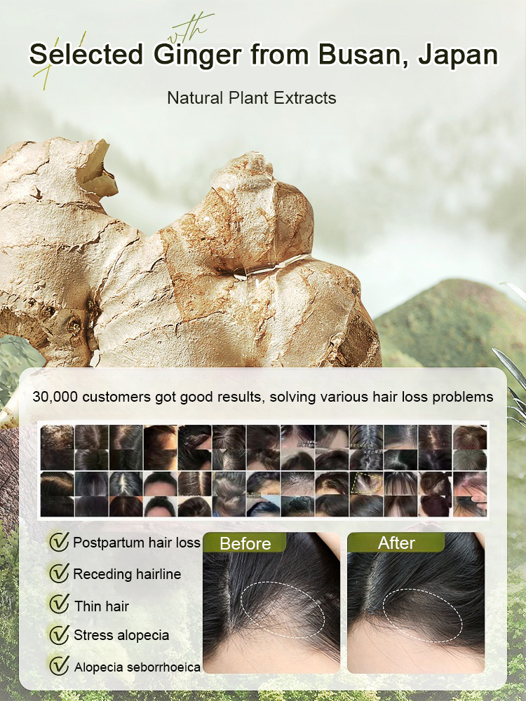 Hot Sale Ginger Plant Extract Anti-Hair Loss Hair Shampoo
