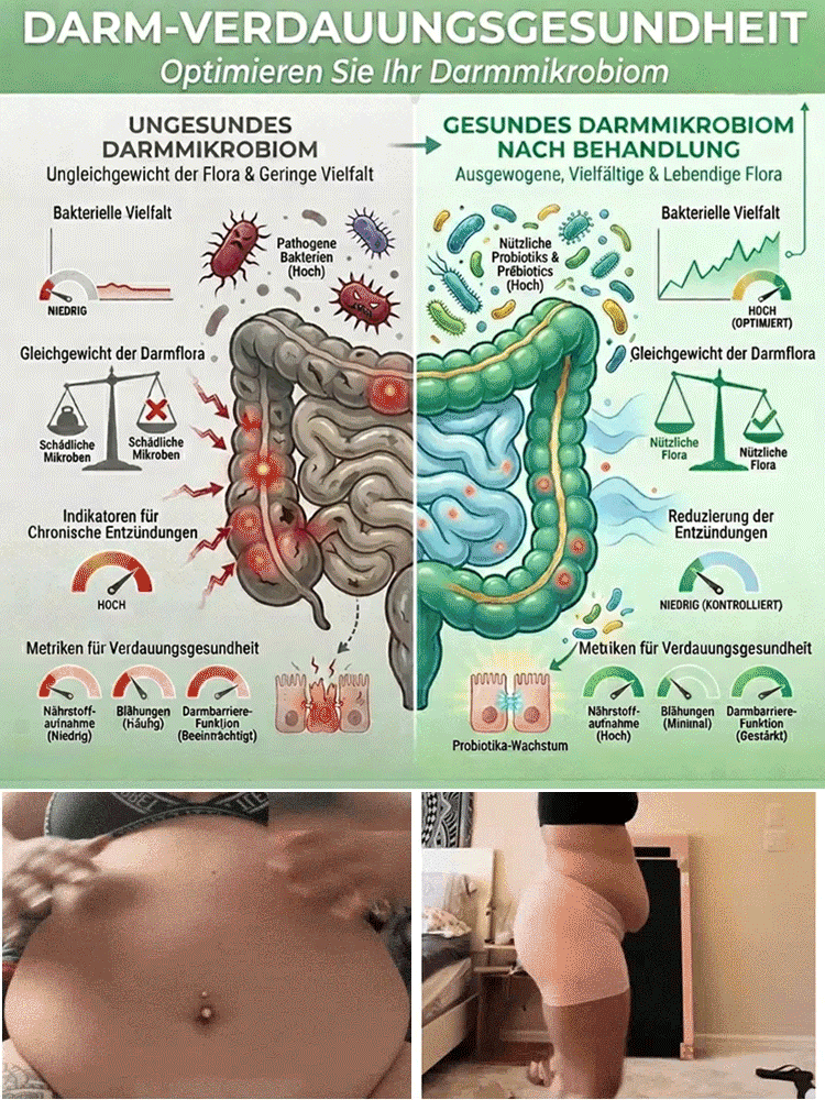 【Ausgleich des Blutzuckerspiegels】Fortschrittliches Nano-Mikronadel-Pflaster