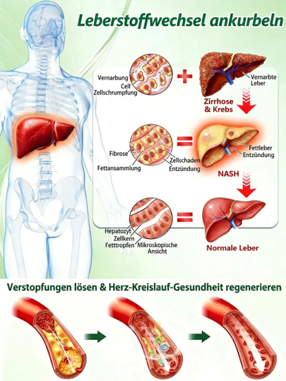 【Ausgleich des Blutzuckerspiegels】Fortschrittliches Nano-Mikronadel-Pflaster