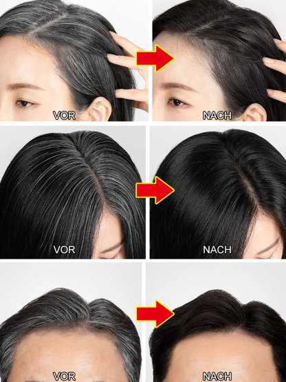 Graues Haar wird schwarz, verhindert Haarausfall, 15 Tage kostenlose Probe