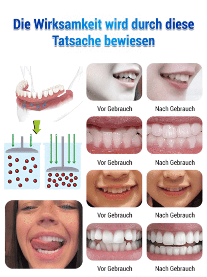 Passt in einer Sekunde, so bequem wie echte Zähne, hält 68 Stück 