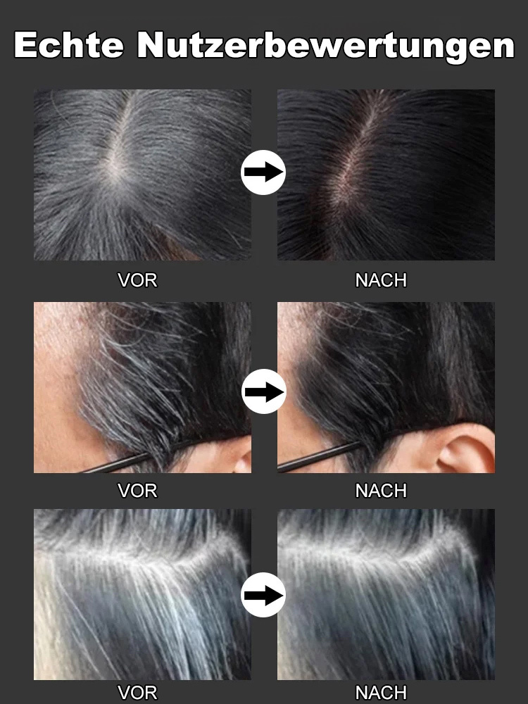 Graues Haar wird schwarz, verhindert Haarausfall, 15 Tage kostenlose Probe