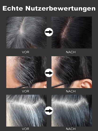 Graues Haar wird schwarz, verhindert Haarausfall, 15 Tage kostenlose Probe