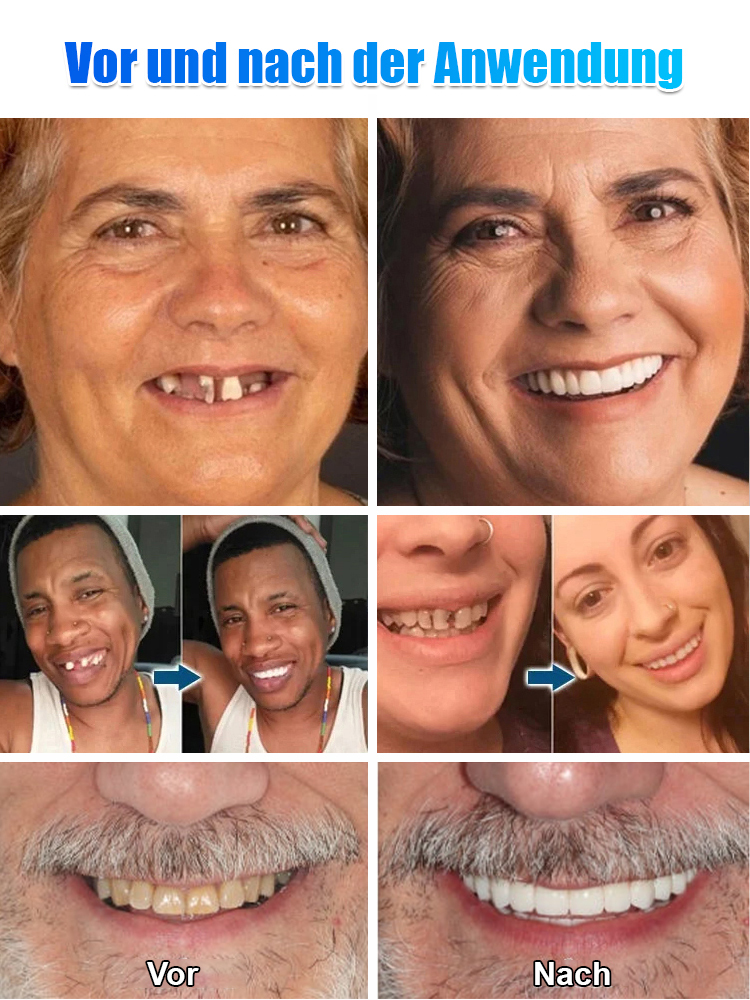 Zahnprothesen Kosmetik Set