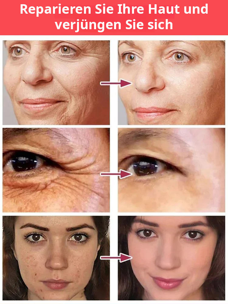 Rekombinantes Kollagen-Anti-Falten-Serum 🌿 Zieht sofort nach einmaliger Anwendung ein und hinterlässt keinen fettigen Film