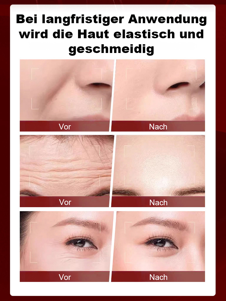 [Superschnelle Reduzierung von Nasolabialfalten] Feuchtigkeitsspendendes und revitalisierendes Anti-Aging-Spray