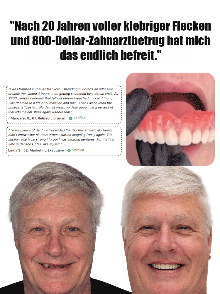 🔒Kein Klebstoff erforderlich, es haftet fest am Zahnfleisch, löst sich beim Sprechen oder Kauen nicht so leicht und ist für Menschen jeden Alters einfach anzuwenden.