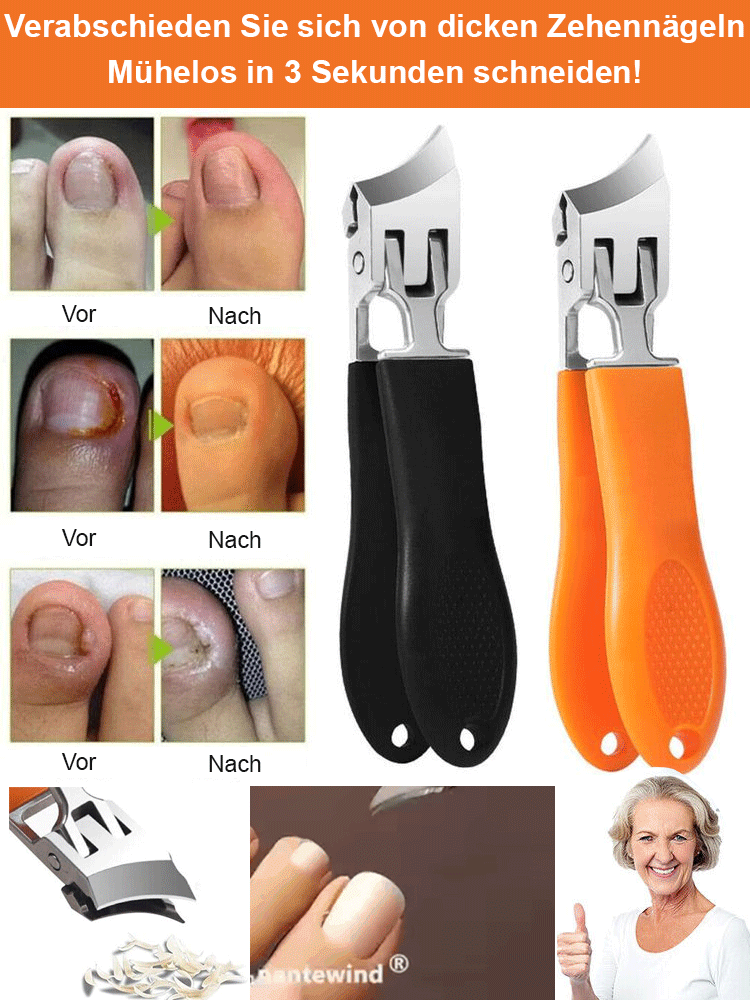 Paronychie Spezial-Nagelknipser-Set mit schräger Spitze✂️Präziser Schnitt bis zur Wurzel, ideal für eingewachsene, dicke Nägel und Nagelpilz