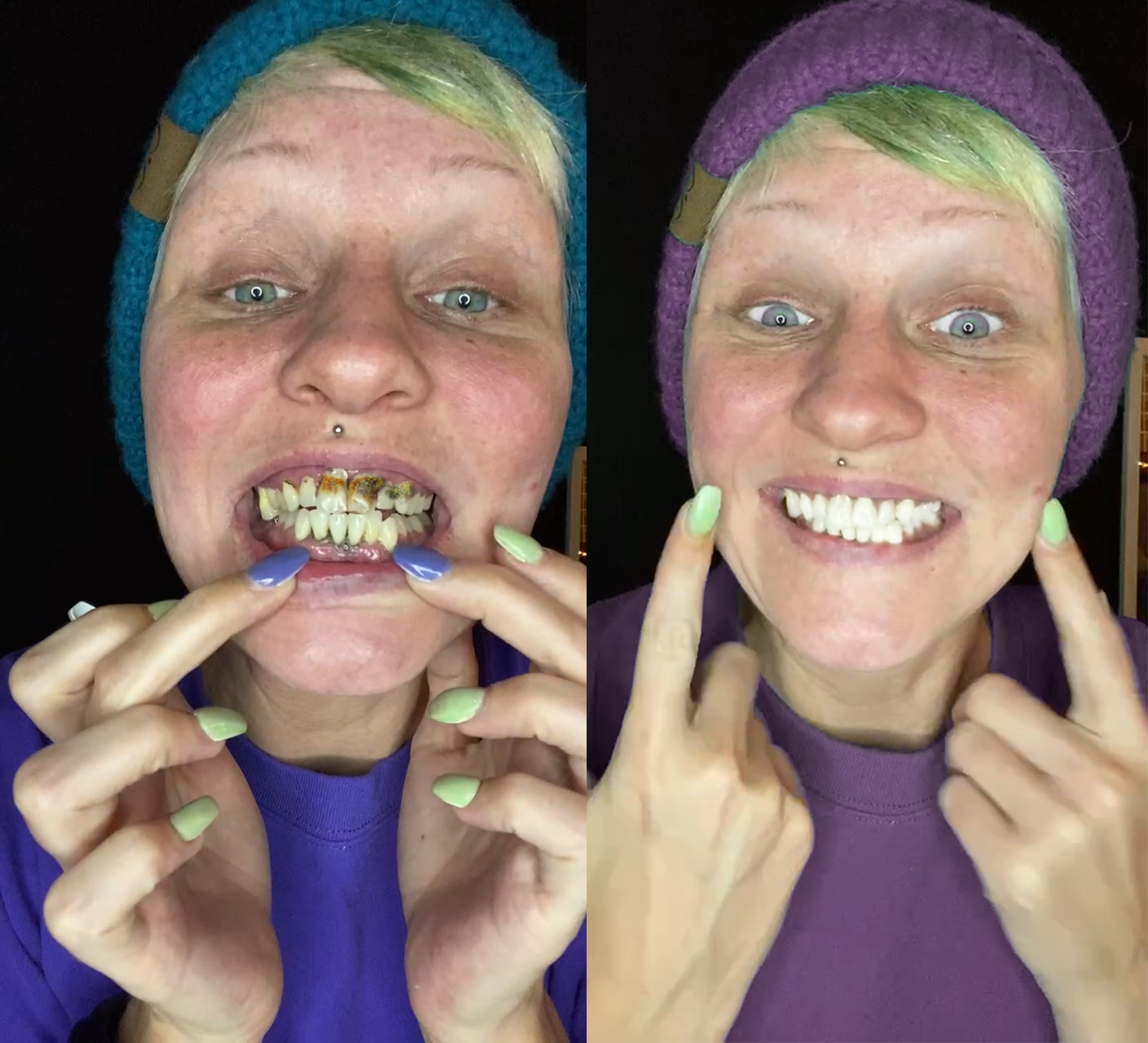 Oyikey® Tooth Restoration Mineral Powder