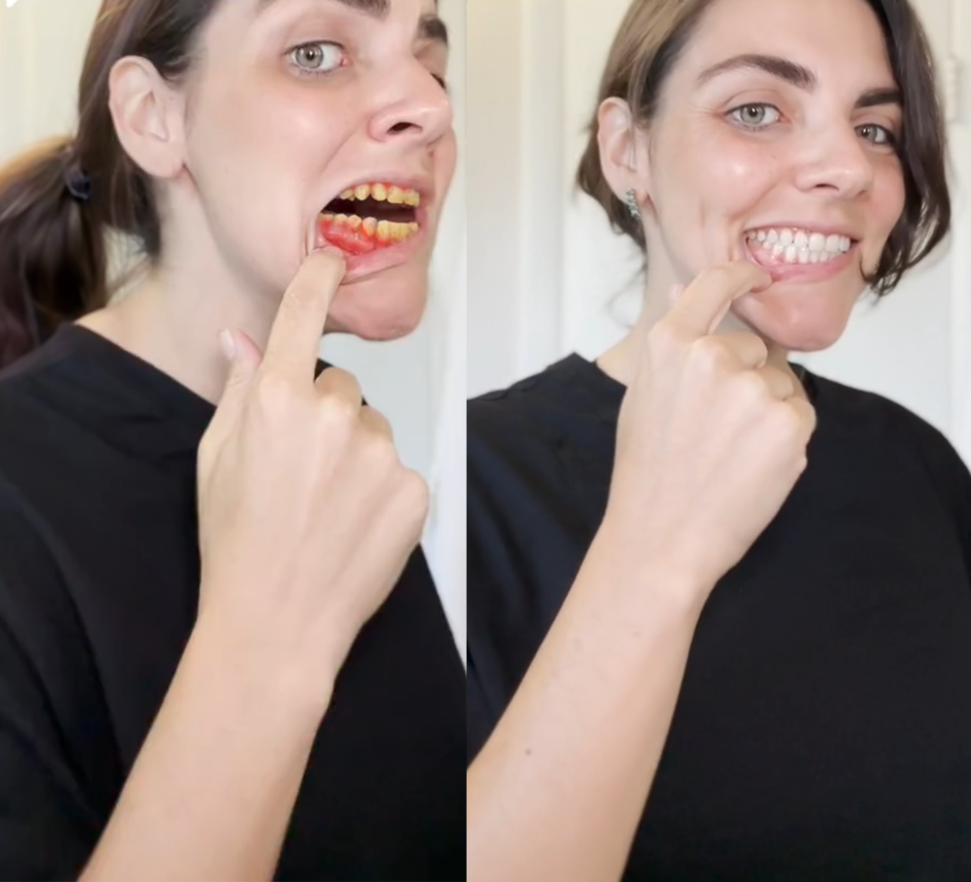 Oyikey® Tooth Restoration Mineral Powder