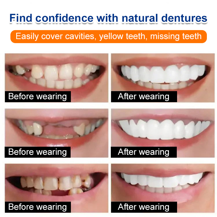 No need for expensive dental treatment, no pain, no waiting,🦷🦷 a confident smile in 3 seconds😀😀
