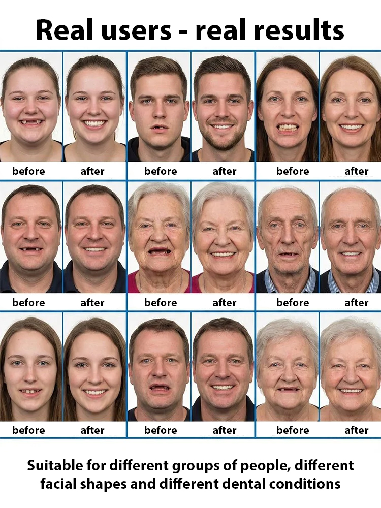 Perfect Face Contour Fit | Adaptive Full Coverage With Braces Compatible