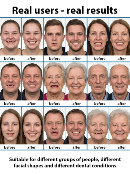 Perfect Face Contour Fit | Adaptive Full Coverage With Braces Compatible