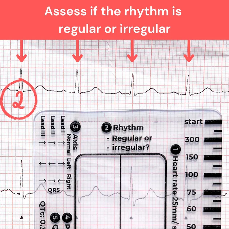 ECG 7 Step Ruler