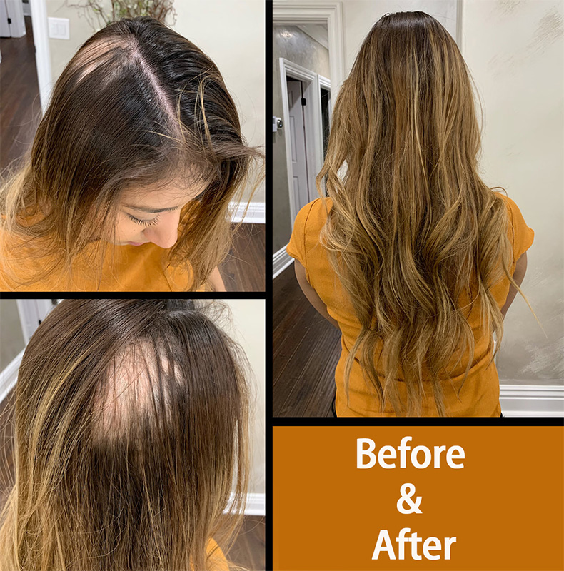 Goopatch Seamless Injected Hand-Tied Invisible Tape In Hair Extension -- 100% VIRGIN HUMAN HAIR / 10 PIECES