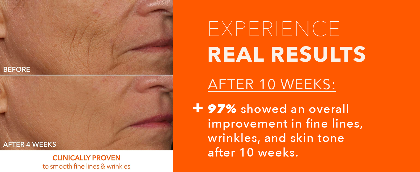 DR DENNIS GROSS DRx SpectraLite FaceWare Pro RESULTS