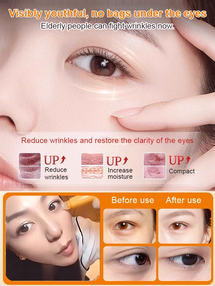 【Eye SPA Lutein Firming Essence Oil】50%OFF🔖More effective than doing three face masks.