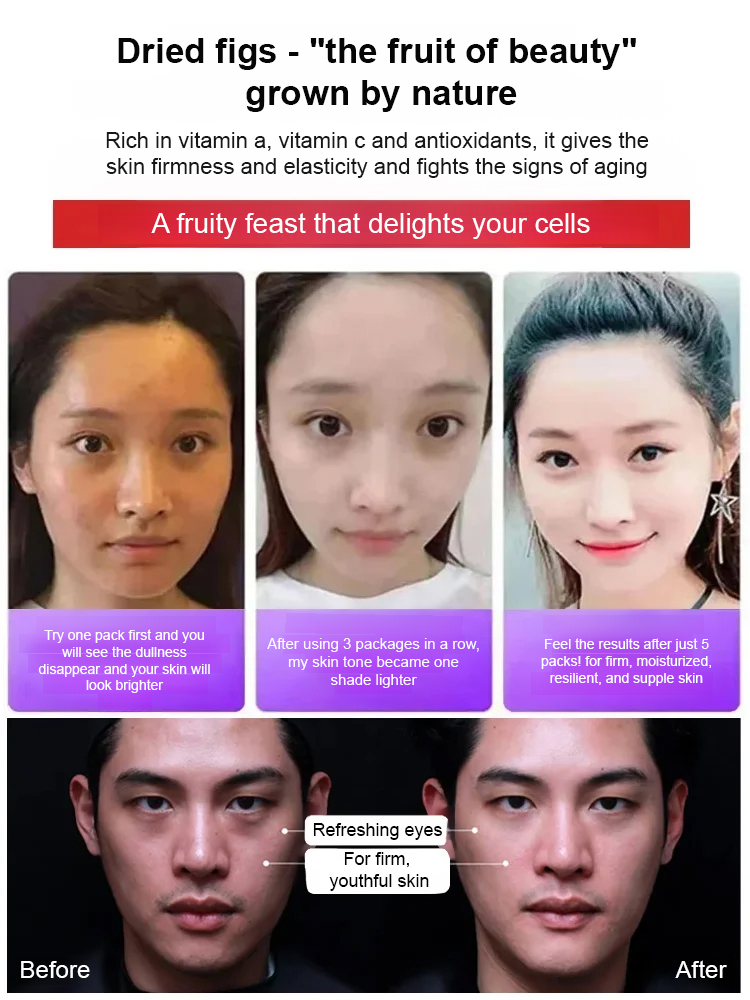 【Fresh Fruit】Sugar-free Dried Figs