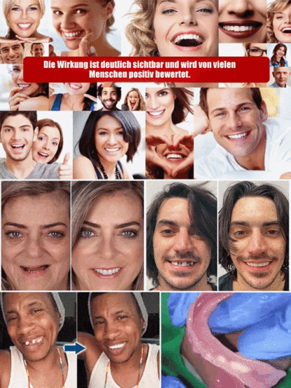 👍🏻Kein Klebstoff erforderlich, Installation in 1 Sekunde. Bequemer Prothesen-Satz für optimale Gesichtsstütze, empfohlen von Experten