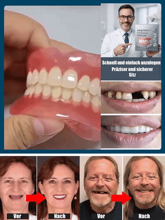 👍🏻Kein Klebstoff erforderlich, Installation in 1 Sekunde. Bequemer Prothesen-Satz für optimale Gesichtsstütze, empfohlen von Experten