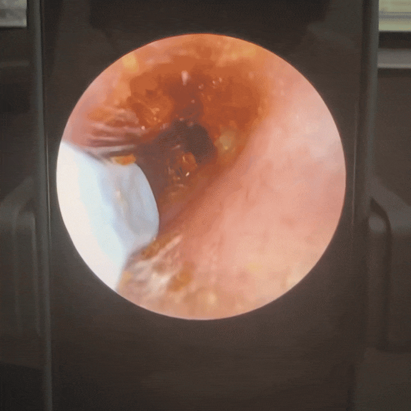 Doctor Approved Ear Health Technology