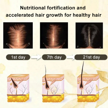 Still struggling with hair loss? Try this Rollerball Hair Serum! Strengthen your hair from the roots!