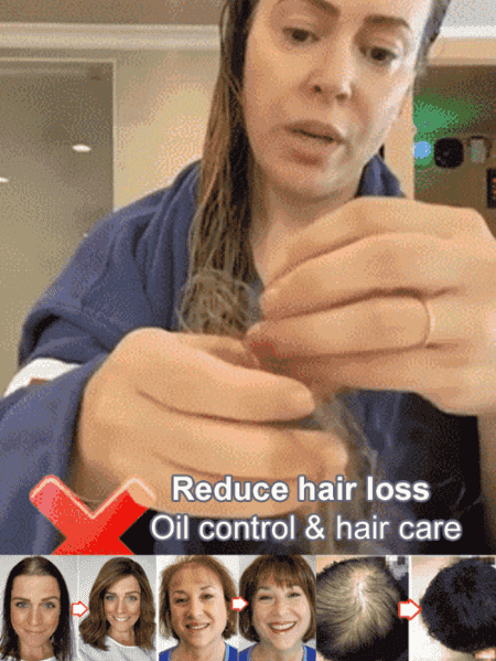 【10 years younger】❤️Hot Sale Ginger Plant Extract Anti-Hair Loss Hair Shampoo